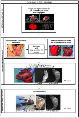 Frozen Section Analysis and Real-Time Magnetic Resonance Imaging of Surgical Specimen Oriented on 3D Printed Tongue Model to Assess Surgical Margins in Oral Tongue Carcinoma: Preliminary Results